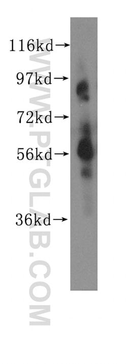 CHRNA6 Rabbit anti-Human, Mouse, Rat, Polyclonal, Proteintech 150 &mu;L;