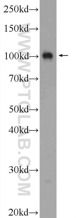 PWP2 Rabbit anti-Human, Polyclonal, Proteintech:Antibodies:Primary Antibodies