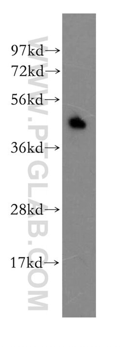 EPCR Rabbit anti-Human, Polyclonal, Proteintech 150 &mu;L; Unconjugated:Antibodies,