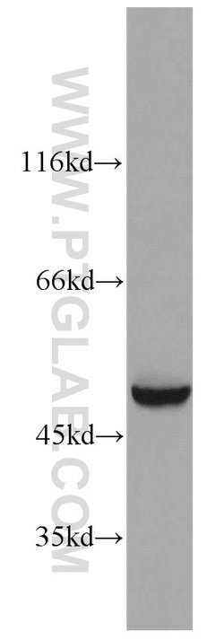 EEF1A1 Rabbit anti-Human, Mouse, Rat, Polyclonal, Proteintech 150 &mu;L;