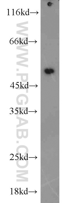 EEF1A1 Rabbit anti-Human, Mouse, Rat, Polyclonal, Proteintech 150 &mu;L;