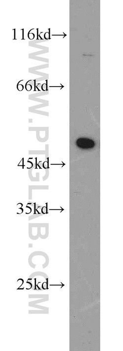 EEF1A1 Rabbit anti-Human, Mouse, Rat, Polyclonal, Proteintech 150 &mu;L;