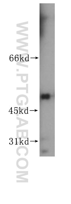 EEF1A1 Rabbit anti-Human, Mouse, Rat, Polyclonal, Proteintech 150 &mu;L;