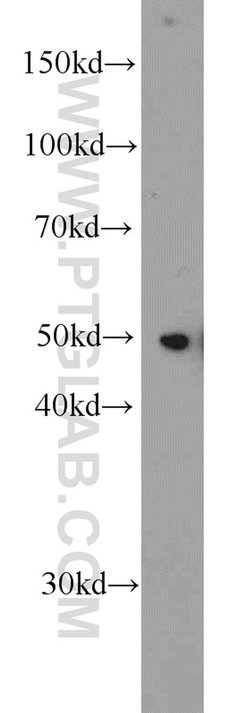 EEF1A1 Rabbit anti-Human, Mouse, Rat, Polyclonal, Proteintech 150 &mu;L;