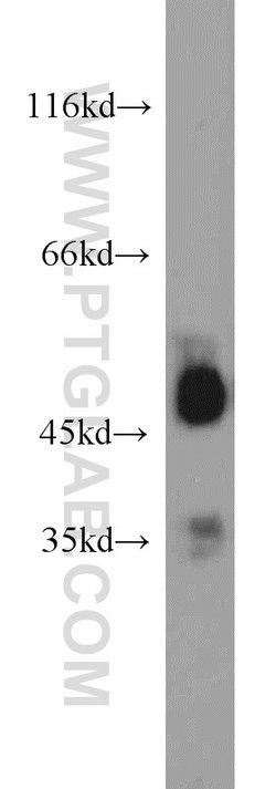 EEF1A1 Rabbit anti-Human, Mouse, Rat, Polyclonal, Proteintech 150 &mu;L;
