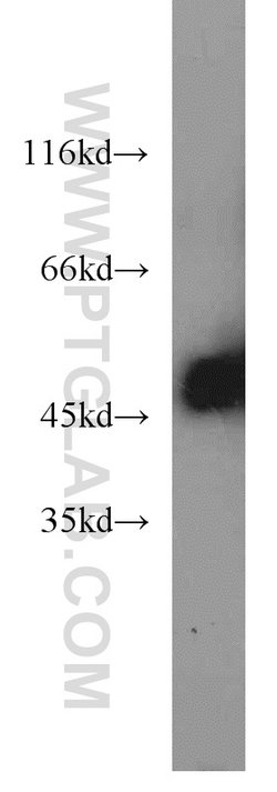 EEF1A1 Rabbit anti-Human, Mouse, Rat, Polyclonal, Proteintech 150 &mu;L;