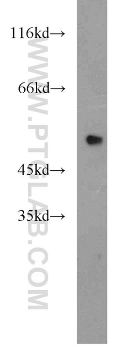 EEF1A1 Rabbit anti-Human, Mouse, Rat, Polyclonal, Proteintech 150 &mu;L;