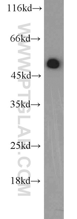 EEF1A1 Rabbit anti-Human, Mouse, Rat, Polyclonal, Proteintech 150 &mu;L;