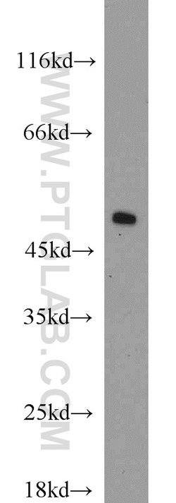 EEF1A1 Rabbit anti-Human, Mouse, Rat, Polyclonal, Proteintech 150 &mu;L;