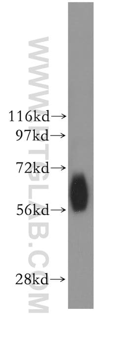 NDOR1/NR1 Rabbit anti-Human, Mouse, Rat, Polyclonal, Proteintech 150 &mu;L;