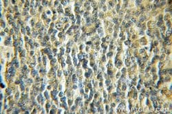 NDOR1/NR1 Rabbit anti-Human, Mouse, Rat, Polyclonal, Proteintech 150 &mu;L;