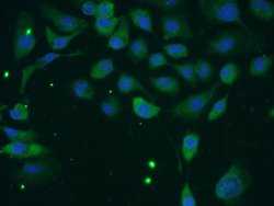 TACC2 Rabbit anti-Human, Mouse, Rat, Polyclonal, Proteintech
