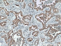 TACC2 Rabbit anti-Human, Mouse, Rat, Polyclonal, Proteintech 150 &mu;L;