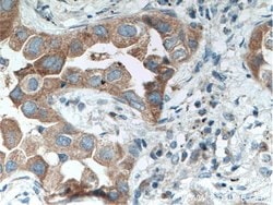 TACC2 Rabbit anti-Human, Mouse, Rat, Polyclonal, Proteintech 150 &mu;L;