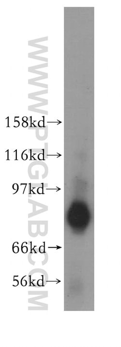 TACC2 Rabbit anti-Human, Mouse, Rat, Polyclonal, Proteintech 150 &mu;L;