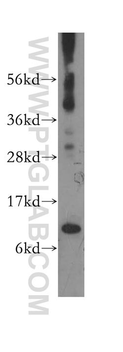 COX7A1 Rabbit anti-Human, Mouse, Polyclonal, Proteintech:Antibodies:Primary