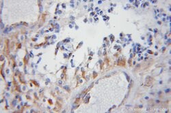 COX5B Rabbit anti-Human, Mouse, Rat, Polyclonal, Proteintech 20 &mu;L | Buy Online | Proteintech | Fisher Scientific