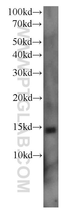 COX5B Rabbit anti-Human, Mouse, Rat, Polyclonal, Proteintech 20 &mu;L | Buy Online | Proteintech | Fisher Scientific