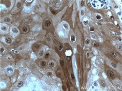 HOPX Rabbit anti-Human, Mouse, Rat, Polyclonal, Proteintech 150 &mu;L;