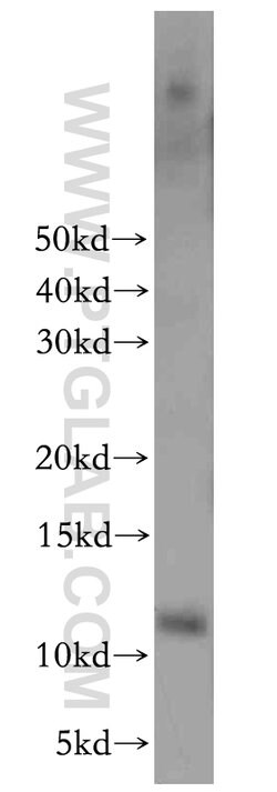 HOPX Rabbit anti-Human, Mouse, Rat, Polyclonal, Proteintech 150 &mu;L;