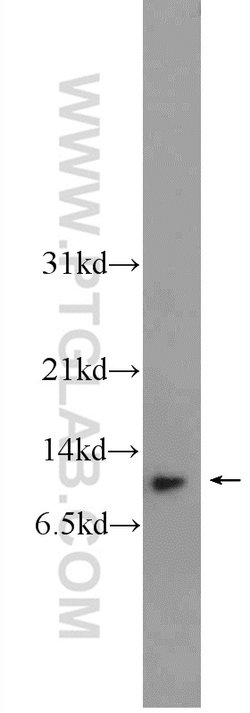 HOPX Rabbit anti-Human, Mouse, Rat, Polyclonal, Proteintech 150 &mu;L;