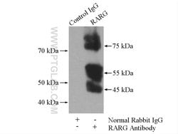 RARG Rabbit anti-Human, Mouse, Rat, Polyclonal, Proteintech:Antibodies:Primary