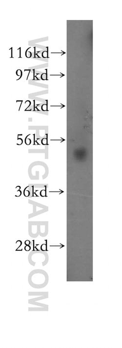 RARG Rabbit anti-Human, Mouse, Rat, Polyclonal, Proteintech:Antibodies:Primary