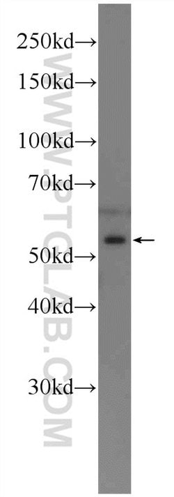 RARG Rabbit anti-Human, Mouse, Rat, Polyclonal, Proteintech:Antibodies:Primary