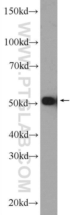 HNRNPK Rabbit anti-Human, Mouse, Rat, Polyclonal, Proteintech 20 &mu;L;