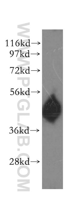 Kallistatin Rabbit anti-Human, Polyclonal, Proteintech 150 &mu;L; Unconjugated:Antibodies,