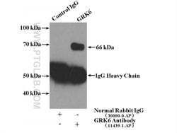 GRK6 Rabbit anti-Human, Mouse, Rat, Polyclonal, Proteintech:Antibodies:Primary