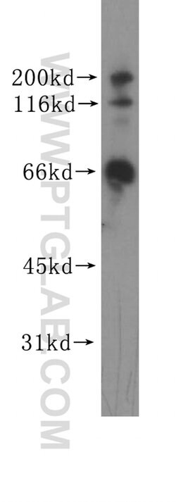 GRK6 Rabbit anti-Human, Mouse, Rat, Polyclonal, Proteintech:Antibodies:Primary