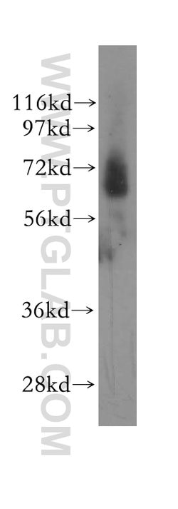 GRK6 Rabbit anti-Human, Mouse, Rat, Polyclonal, Proteintech:Antibodies:Primary