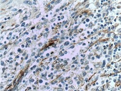 VCAM-1 Rabbit anti-Human, Polyclonal, Proteintech 150 &mu;L; Unconjugated:Antibodies,