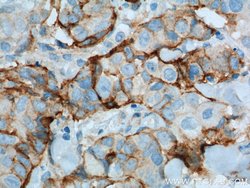 VCAM-1 Rabbit anti-Human, Polyclonal, Proteintech 150 &mu;L; Unconjugated:Antibodies,