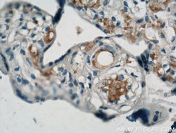 VCAM-1 Rabbit anti-Human, Polyclonal, Proteintech 150 &mu;L; Unconjugated:Antibodies,