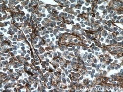 VCAM-1 Rabbit anti-Human, Polyclonal, Proteintech 150 &mu;L; Unconjugated:Antibodies,