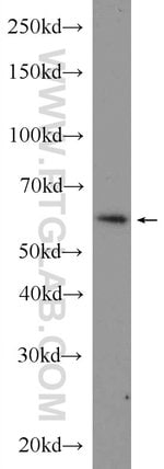 Thumbnail_GTF3C5 Rabbit anti-Human, Mouse, Rat, Polyclonal, Proteintech:Anticorps:Anticorps