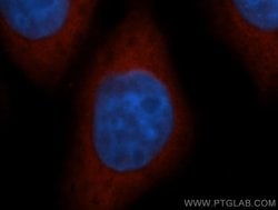 NQO1 Rabbit anti-Human, Polyclonal, Proteintech 150 &mu;L; Unconjugated:Antibodies,