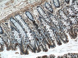 NQO1 Rabbit anti-Human, Polyclonal, Proteintech 150 &mu;L; Unconjugated:Antibodies,