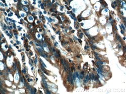 NQO1 Rabbit anti-Human, Polyclonal, Proteintech 150 &mu;L; Unconjugated:Antibodies,