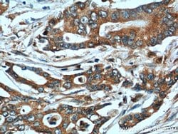 NQO1 Rabbit anti-Human, Polyclonal, Proteintech 150 &mu;L; Unconjugated:Antibodies,