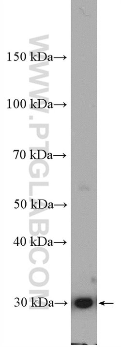 NQO1 Rabbit anti-Human, Polyclonal, Proteintech 150 &mu;L; Unconjugated:Antibodies,