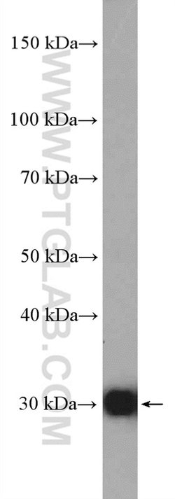 NQO1 Rabbit anti-Human, Polyclonal, Proteintech 150 &mu;L; Unconjugated:Antibodies,