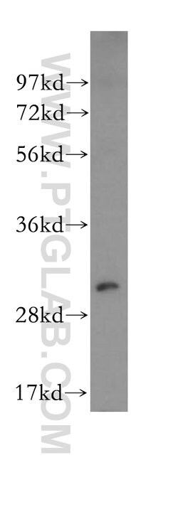 NQO1 Rabbit anti-Human, Polyclonal, Proteintech 150 &mu;L; Unconjugated:Antibodies,