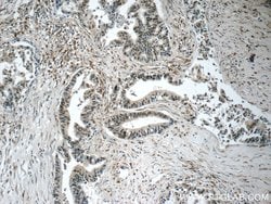 MIER1 Rabbit anti-Human, Mouse, Rat, Polyclonal, Proteintech 150 &mu;L;
