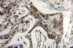 MIER1 Rabbit anti-Human, Mouse, Rat, Polyclonal, Proteintech 150 &mu;L;
