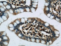 MZB1 Rabbit anti-Human, Polyclonal, Proteintech:Antibodies:Primary Antibodies