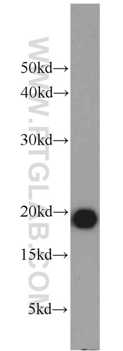 MZB1 Rabbit anti-Human, Polyclonal, Proteintech:Antibodies:Primary Antibodies