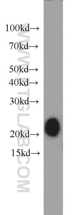 MZB1 Rabbit anti-Human, Polyclonal, Proteintech:Antibodies:Primary Antibodies